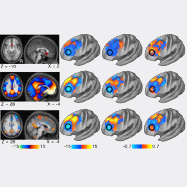 TMS-fMRI-01