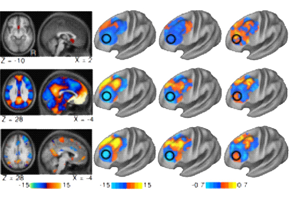 TMS-fMRI