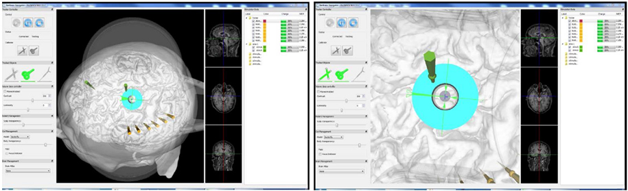 Positioning Accuracy and Repeatability