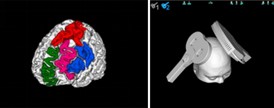 Support Custom Brain Functional Areas