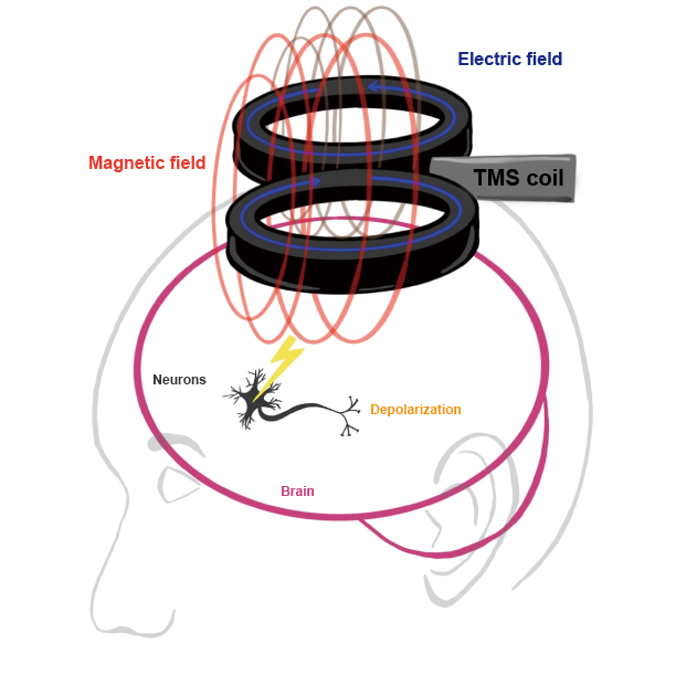 the basic principle of TMS