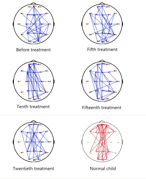 Graph. Topology of brain network