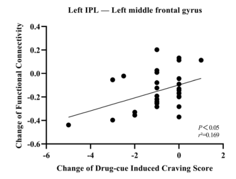 Regression analysis